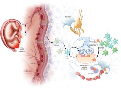 Fetal Neuroprotective Strategies: Therapeutic Agents and Their Underlying Synaptic Pathways